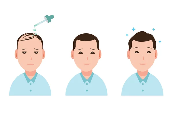 Man Treat Hair Loss Vector Isolated White Background Increase Density — 스톡 벡터