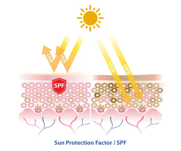 Spf Fator Proteção Solar Bloqueia Radiação Uvb Penetrar Vetor Camada — Vetor de Stock