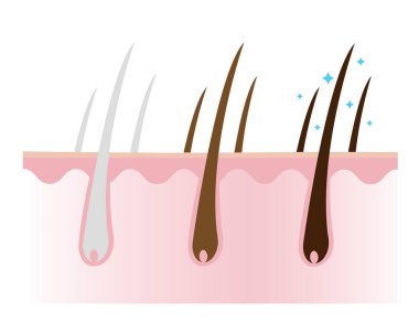 Reduce white, gray hair and make hair darker with scalp layer vector isolated on white background. Solution for greying and darkening hair. Hair care concept illustration.