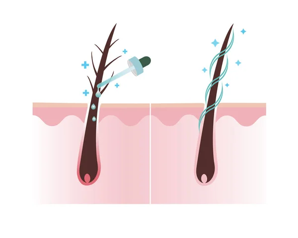 Treat Damage Hair Treatment Healthy Hair Scalp Layer Vector White — Stockový vektor