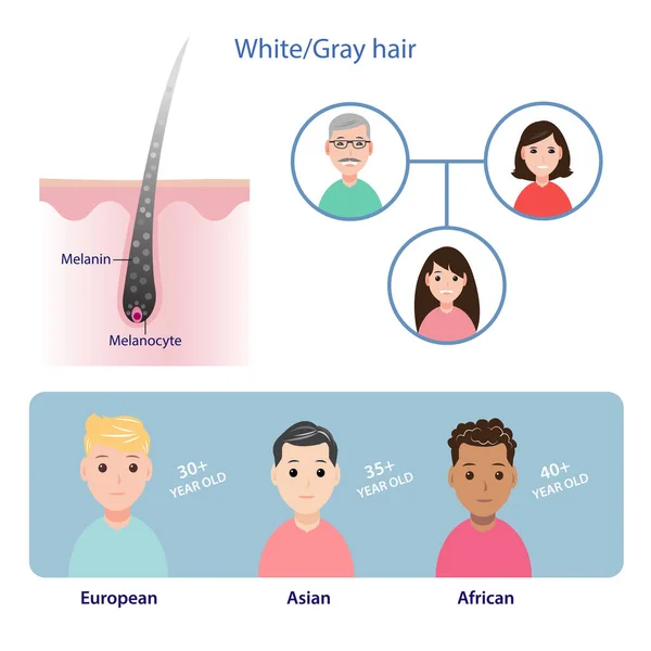 Mechanism Hair Graying Scalp Layer Can Inherited Parents Average Ages — Stok Vektör