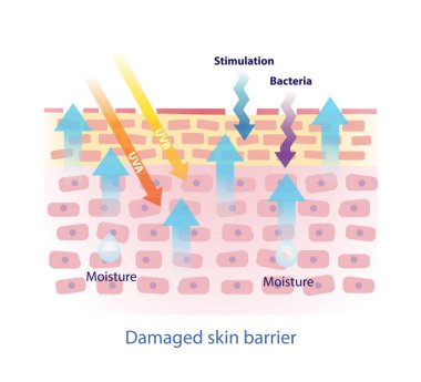 Damaged skin barrier vector on white background. The weak skin barrier make tight arrangement between cells is lost, irritants to get in easier and dehydrated skin. Skin care and beauty concept.