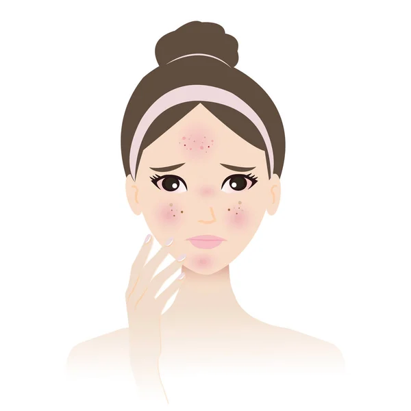 女性の皮膚アレルギーは白い背景に隔離されたベクトルに直面しています アレルギー反応皮膚は かゆみ バンプ じんましん および腫れになります 皮膚問題の概念図 — ストックベクタ