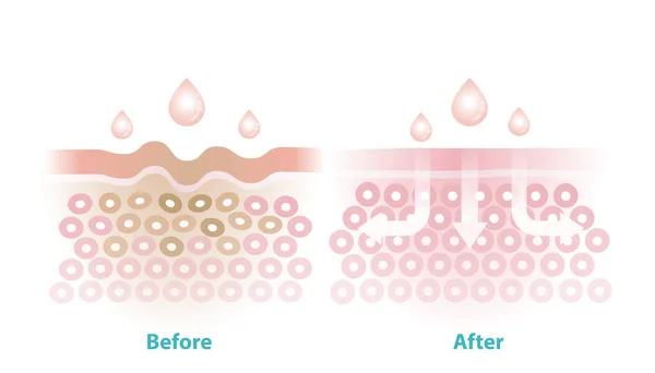 前と後のスキンケア白の背景に分離しわベクトルイラストを減少させます しわの断面皮膚や皮膚の老化や損傷を軽減するために吸収するスキンケア — ストックベクタ