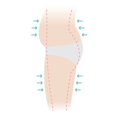 Kadının göbeğinde, kalçasında ve kalçasında oklar, noktalı çizgiler, beyaz arka planda izole edilmiş vektör illüstrasyonunu gösteriyor. Aşırı kilolu, yağ aldırma, selülit aldırma, deri kaldırma konsepti.