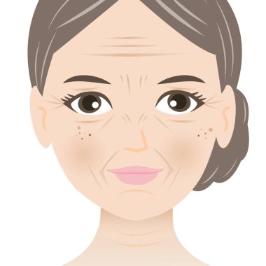 Facial wrinkles woman vector illustration isolated on white background. Forehead, Bunny, Marionette, Frown lines, Mental crease, Crows feet, Tear troughs, Nasolabial folds, Smile and Neck lines. clipart