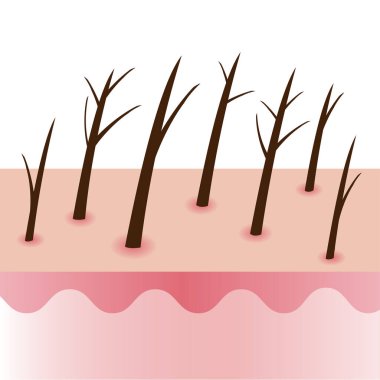 Hasarlı ve kırık uçlar beyaz arka planda izole edilmiş kafa derisi katmanı vektör illüstrasyonunda kıl. Kuraklık, bebek bölünmesi, bölünme, tamamlanmamış düğüm, konik, ağaç ve tüy. Saç bakımı ve sorun konsepti.