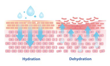 Beyaz arkaplanda izole edilmiş hidrasyon ve susuzluk katman vektör çizimi mekanizması. Cilt ile su, nem ve kuru cilt karşılaştırıldığında en üst tabakada su eksikliği görülür..