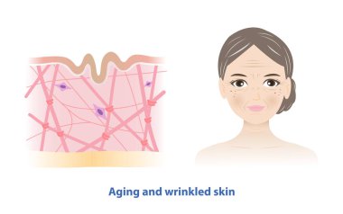 Beyaz arka planda yaşlı ve buruşuk deri taşıyıcısı olan yaşlı kadın. Cilt tabakasında kolajen tükenmesi, elastin lifler ve fibroblastlar var. Cilt bakımı ve güzellik kavramı.