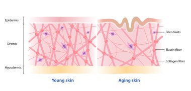 Beyaz arka planda genç ve yaşlanan deri vektörlerinin karşılaştırılması. Cilt tabakasında yüksek ve düşük yoğunlukta kolajen, elastin lifler ve fibroblastlar var. Cilt bakımı ve güzellik kavramı.