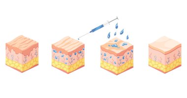 Hyaluronik asit izometrik. Cilt yapı katmanları simgelerini temsil eden profil görünüm küpleri. Deri altı doku, deri altı ve üst deri anatomik yapısı. Çizgi film vektör çizimi beyaz üzerine izole edildi.