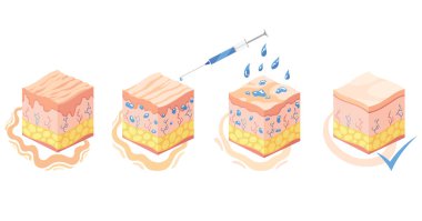 Hyaluronik asit izometrik. Cilt yapı katmanları simgelerini temsil eden profil görünüm küpleri. Deri altı doku, deri altı ve üst deri anatomik yapısı. Çizgi film vektör çizimi beyaz üzerine izole edildi.