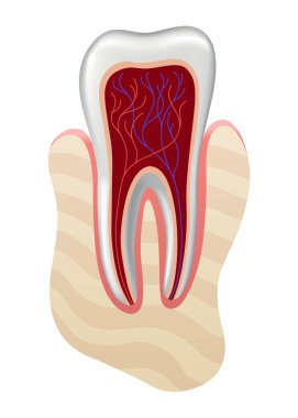 Diş implantı. Tıbbi eğitici bilgi afişi. Diş implantı, dişçiliğin gerçekçi vektör tasarımı. Sağlık, dişçi ve ortodontist tedavisi.