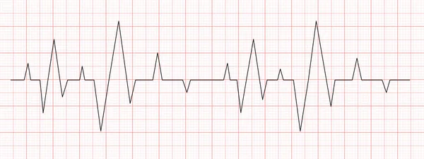 Черное Сердце Бьется Диаграммой Красной Бумаге Карта Электрокардиограммы Сердечный Ритм — стоковый вектор