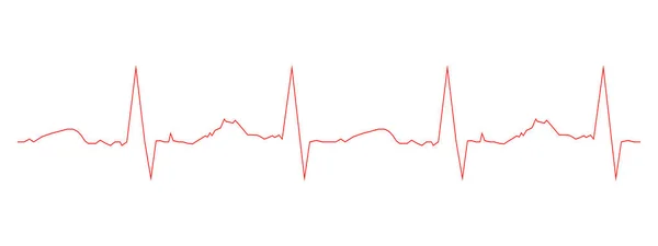 Шаблон Электрокардиограммы Диаграмма Сердцебиения Диаграмма Экг Изолирована Белом Фоне Красная — стоковый вектор