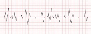 Kırmızı grafik kağıdında siyah kalp atışı diyagramı. Elektrokardiyogram şeması. Kardiyo test hattı. Kalp ritmi sembolü. Vektör grafik illüstrasyonu.