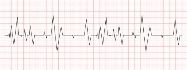 Черная Диаграмма Сердцебиения Красной Бумаге Карта Электрокардиограммы Тестирование Сердца Символ — стоковый вектор