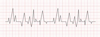 Kırmızı grafik kağıdında siyah kalp atışı çizelgesi. Elektrokardiyogram hattı. Kalp ritmi ya da kardiyo testi. Kardiyoloji hastanesinin sembolü. Vektör grafik illüstrasyonu
