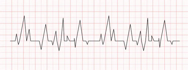 Gráfico Latidos Del Corazón Negro Papel Gráfico Rojo Línea Electrocardiograma — Vector de stock