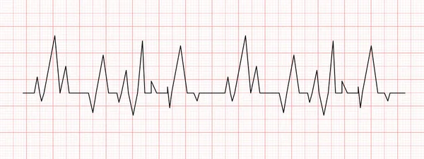 Black Heartbeat Chart Red Graph Paper Electrocardiogram Line Cardiac Rhythm — Stock Vector