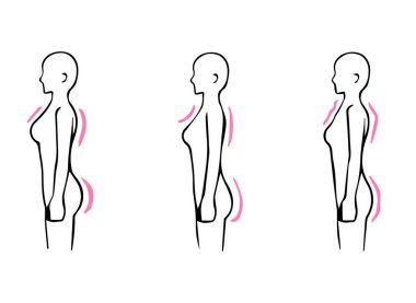 İskelet yapısı tanısı 3 tip vücut şekli illüstrasyonu (Düz, Dalgalı, Doğal)