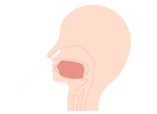 Líquido Hisopo Nasal Diagrama Recogida Muestras Ilustración — Archivo Imágenes Vectoriales