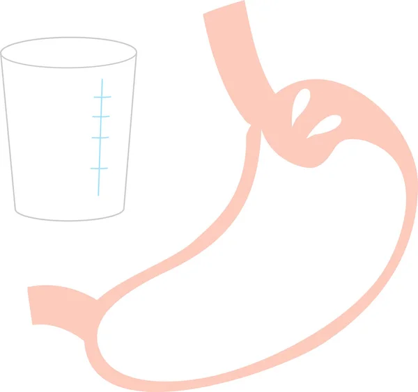 バリウム検査胃の検査のイラスト — ストックベクタ