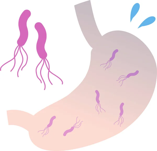 Pylori Cuerpo Humano Estómago Ilustración — Vector de stock