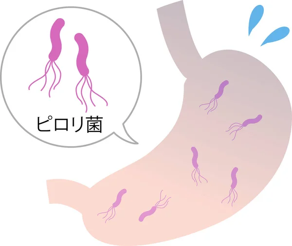 Pylori Human Body Stomach Illustration — стоковий вектор