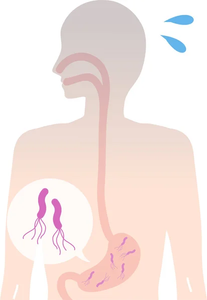 Pylori Cuerpo Humano Estómago Ilustración — Vector de stock