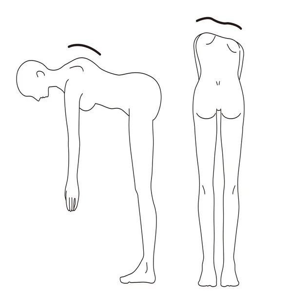 Mujer Postura Médica Verificación Escoliosis Belleza Desnuda Ilustración Espalda Completa — Vector de stock