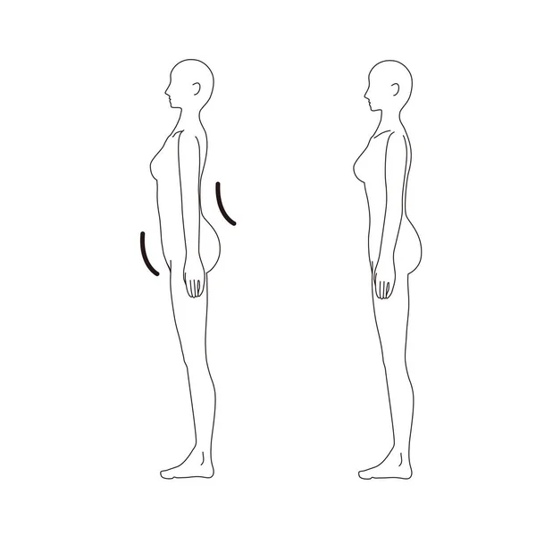 Mujer Médico Postura Encorvado Espalda Belleza Desnudo Cuerpo Completo Horizontal — Archivo Imágenes Vectoriales