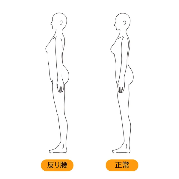 Mulher Postura Médica Curvado Volta Beleza Nua Corpo Inteiro Horizontal —  Vetores de Stock