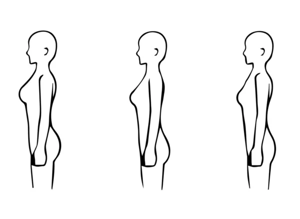 Skelettstruktur Diagnos Typer Kroppsform Illustration Rak Vågig Naturlig — Stock vektor