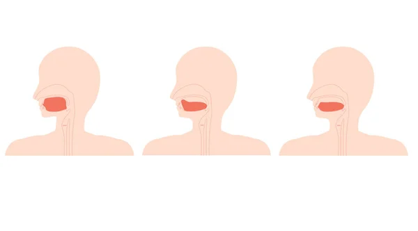 说明正确的舌位置和低舌 — 图库矢量图片
