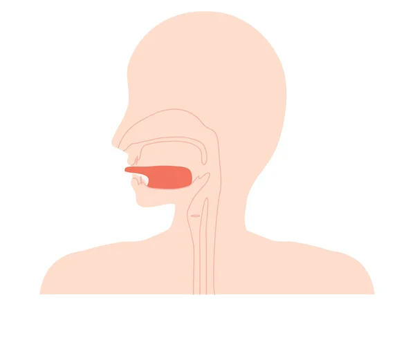 舌因咽喉缩短而不能伸展的舌的图例 — 图库矢量图片
