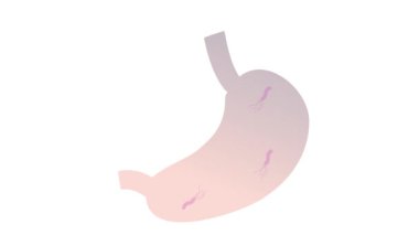 stomach kidneys vector illustrationAnimation video of stomach infected with Helicobacter pylori