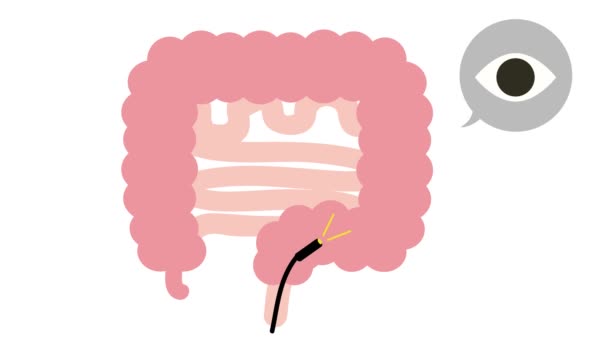 Brain Icon Illustration Flat Styleanimated Video Bowel Examination — Vídeo de Stock