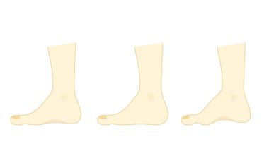 Normal ve düz taban çizimleri.