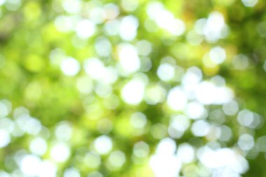 Fotoğraf, görüntü sensörü vasıtasıyla ya da fotoğraf filmi gibi ışığa duyarlı bir materyal aracılığıyla elektronik olarak görüntü oluşturma sanatı, uygulaması ve uygulamasıdır..