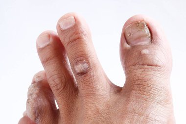 yakın plan - beyaz arka planda tırnağı olan bir kadının fotoğrafı