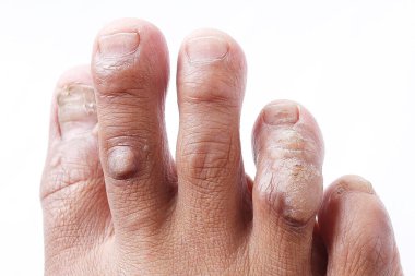 Cilt bakımı. Beyaz arka planda tırnağı olan kadın.