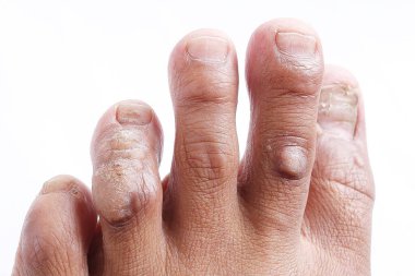 Beyaz arka planda pedikür salonundaki kadın ayakları..