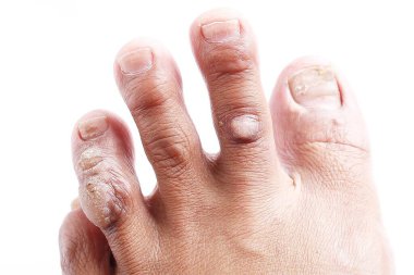 Beyaz bir çiviyle bir adamın elini kapat.