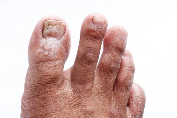 close view on the human skin with a toe and a toe.