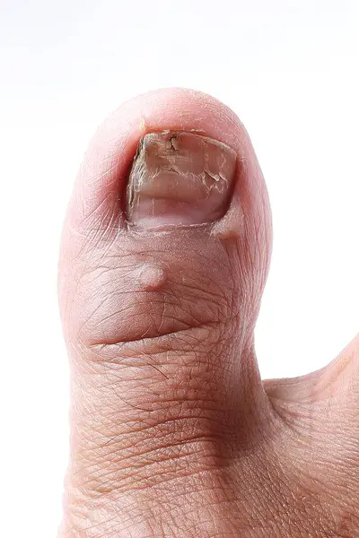 Dedo Humano Com Dedo Pequeno Tiro Close Macrofotografia — Fotografia de Stock