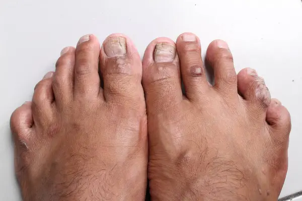 feet of a woman \'s feet