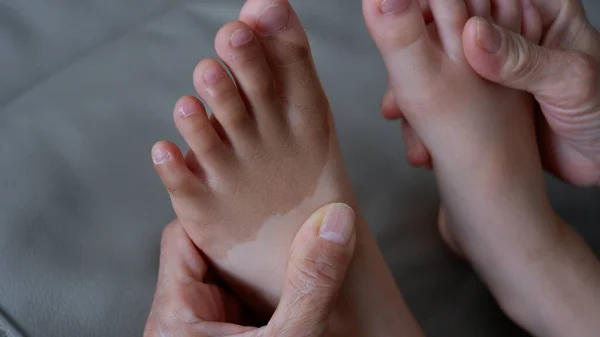 Vitiligo Little Kid Foot Close View — Stok Foto