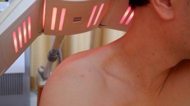 Man doing physiotherapy using an infrared lamp for neck and back. Jakarta, 14 May 2022.