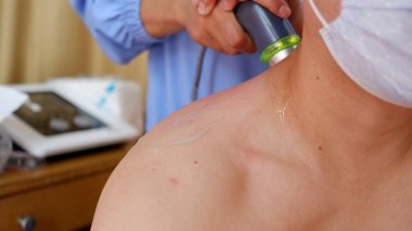 Therapist using Ultrasound therapy on back and neck of man. Jakarta, 13 May 2022.